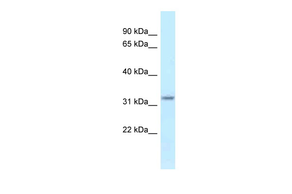 Hsd17b11 antibody - middle region (ARP40842_P050) in Mouse Kidney using Western Blot