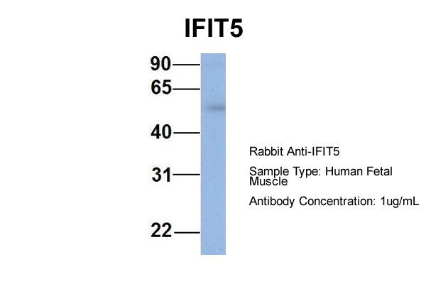 IFIT5 antibody - middle region (ARP54898_P050) in Hum. Fetal Muscle using Western Blot