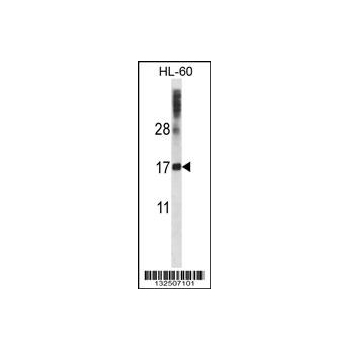 DNAL4 antibody - N - terminal region (OAAB09868) in HL-60 using Western Blot