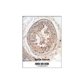 SPAG9 antibody - center region (OAAB04263) in Human Testis using Immunohistochemistry
