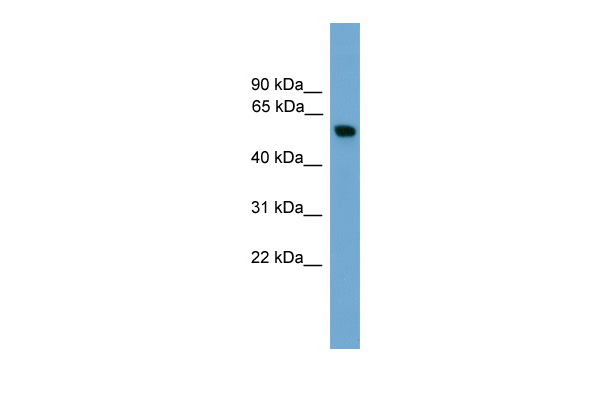 PKM2 antibody - middle region (ARP57789_P050) in Human Heart using Western Blot