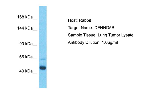 DENND5B Antibody (ARP52769_P050) in Human Lung Tumor using Western Blot