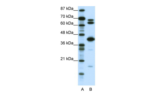 E2F2 antibody - middle region (ARP31611_P050) in Human Jurkat using Western Blot
