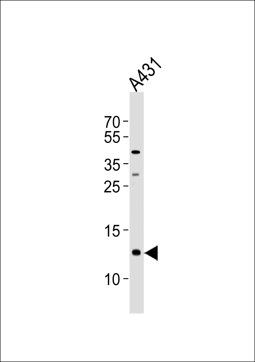 SPRR2A antibody - C-terminal region (OAAB00776) in A431 using Western Blot