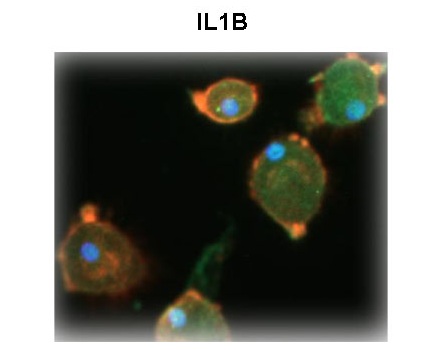 IL1B antibody - N-terminal region (ARP54323_P050) in Human Macrophage using Immunohistochemistry