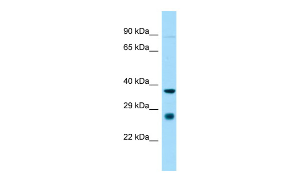 St8sia1 Antibody - middle region (ARP45414_P050) in Rat Heart using Western Blot