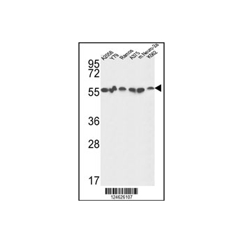 GPI antibody - C-terminal region (OAAB06387) in A2058, Y79, Ramos, A375, K562 and mouse Neuro-2a using Western Blot