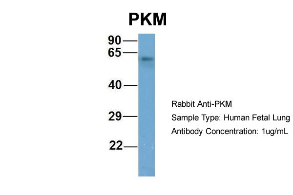 PKM2 antibody - middle region (ARP57789_P050) in Hum. Fetal Lung using Western Blot