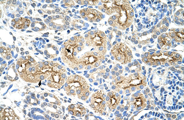 MIF4GD antibody - C-terminal region (ARP40950_T100) in Human Kidney using Immunohistochemistry