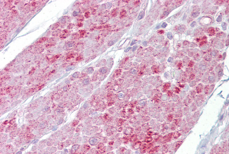 OAS1 antibody - N-terminal region (ARP40401_P050) in Human small intestine using Immunohistochemistry