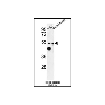 MARVELD2 antibody - C-terminal region (OAAB05811) in WiDr, MDA-MB231 using Western Blot