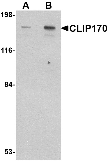 CLIP170 Antibody (OAPB00704) in rat brain using Western Blot