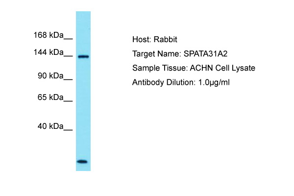 SPATA31A2 Antibody - N-terminal region (ARP70263_P050) in ACHN using Western Blot