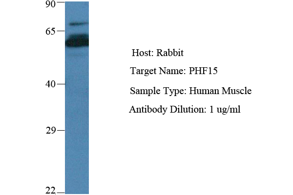 PHF15 Antibody - N-terminal region (ARP39184_P050) in Human Liver Tumor using Western Blot