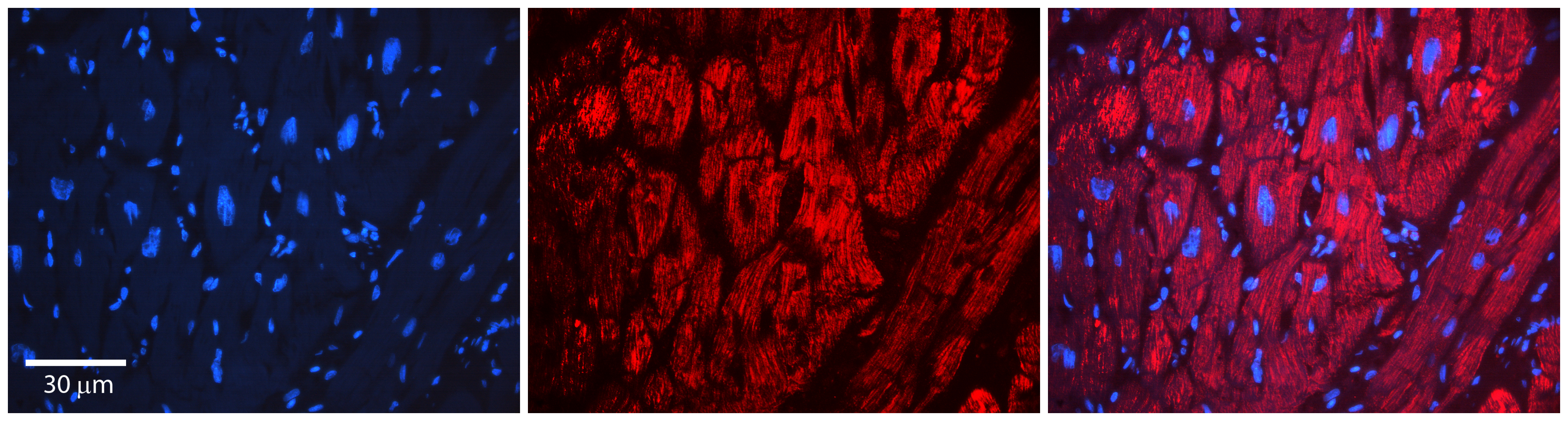 LSS antibody - middle region (ARP41840_P050) in human heart using Immunohistochemistry