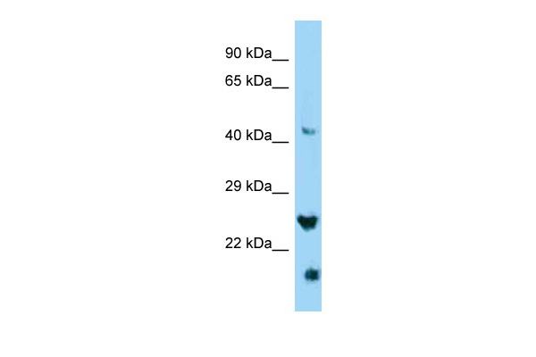 IZUMO4 antibody - C-terminal region (ARP53579_P050) in Human HepG2 using Western Blot
