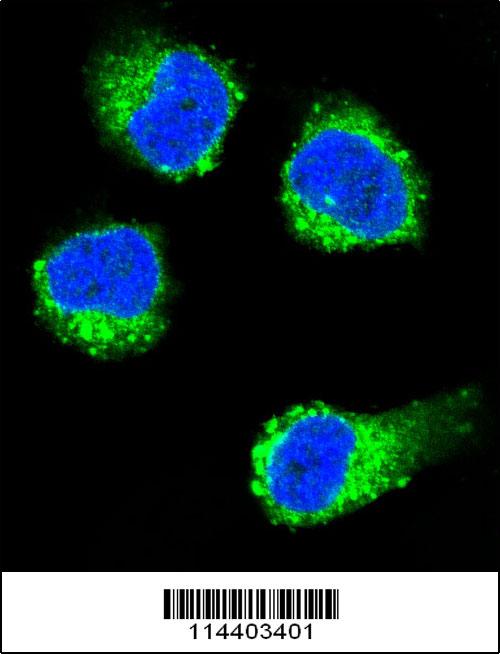 NGF antibody - center region (OAAB04825) in MDA-MB231 using Immunofluorescence