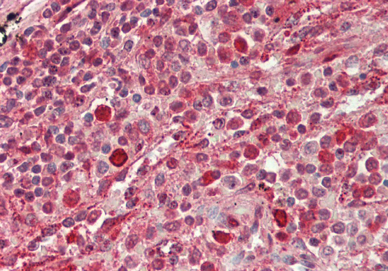 GBP2 antibody - N-terminal region (ARP54714_P050) in Human Spleen using Immunohistochemistry
