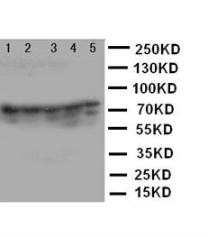 XRCC5 Polyclonal Antibody (OABB00594) in Jurkat, CEM, RAJI, COLO320, HT1080 using Western Blot