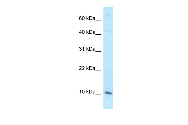 DAP antibody - middle region (ARP60156_P050) in Human HCT15 using Western Blot
