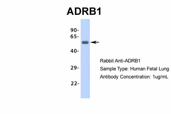 ADRB1 antibody - middle region (ARP36551_P050) in Hum. Fetal Lung using Western Blot