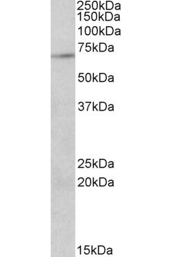 PRMT5 Antibody (OAEB01415) in Jurkatcells using Western Blot
