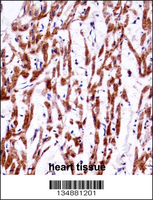 TMM85 antibody - N - terminal region (OAAB11048) in Human Heart using Immunohistochemistry