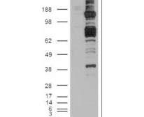 CARD11 Antibody (OAEB02396) in HEK293cells using Western Blot