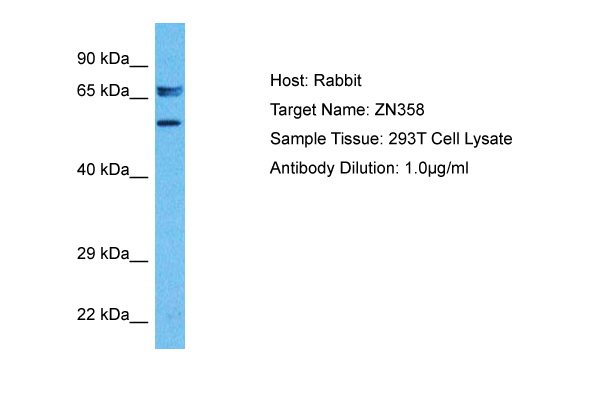 ZN358 Antibody (ARP35947_P050) in Human 293T Whole Cell using Western Blot