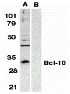 Bcl-10 Antibody (0.1 mg)(OAPB00078) in Raji using Western blot.