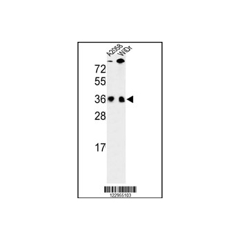 SFRS1 antibody - N-terminal region (OAAB03964) in A2058, WiDr using Western Blot