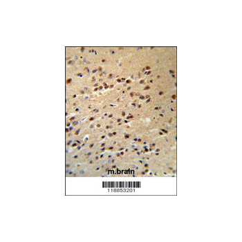 ALS2 antibody - C-terminal region (OAAB03484) in human brain using Immunohistochemistry