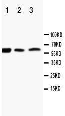 RANK Polyclonal Antibody (OABB00340) in Human Recombinant RANK Protein using Western Blot