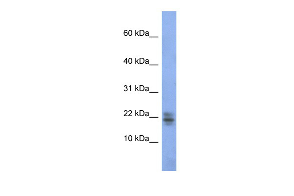 RNASE1 antibody - middle region (ARP40432_P050) in Human kidney using Western Blot