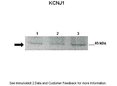 KCNJ1 antibody - middle region (ARP35432_P050) in Mouse renal epithelial using Western Blot