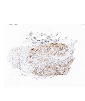 TRPA1 antibody - middle region (ARP35205_P050) in rat sensory ganglia using Immunohistochemistry