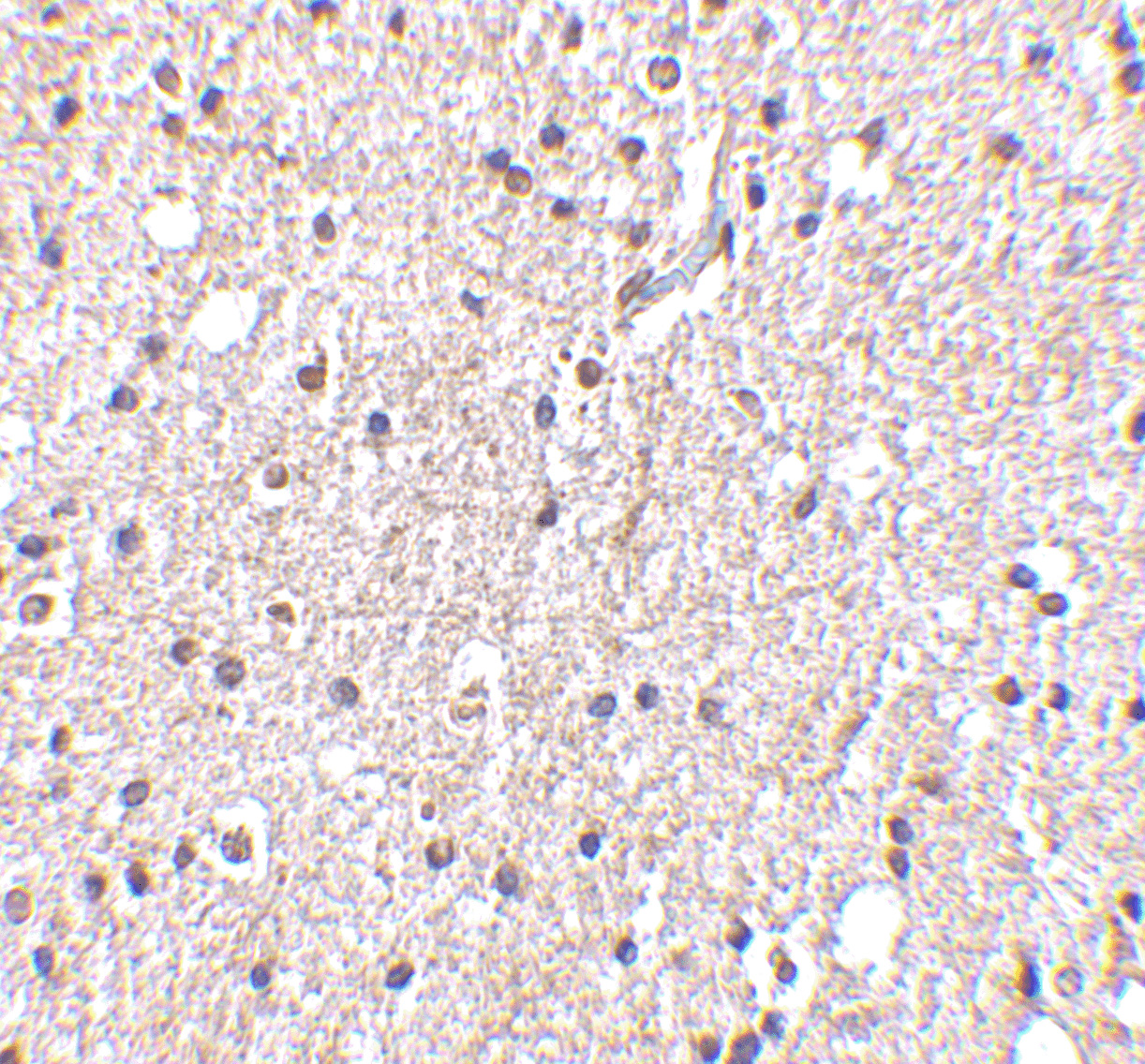 BRSK2 Antibody (OAPB00510) in Human brain using Immunohistochemistry