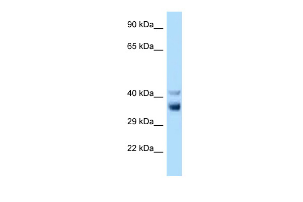 Nek7 antibody - C-terminal region (ARP49000_P050) in Rat Liver using Western Blot