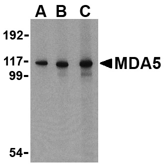 MDA5 Antibody (OAPB00490) in Daudi using Western Blot