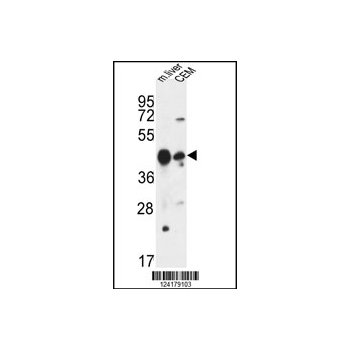 PLA1A antibody - center region (OAAB06145) in mouse liver and CEM using Western Blot