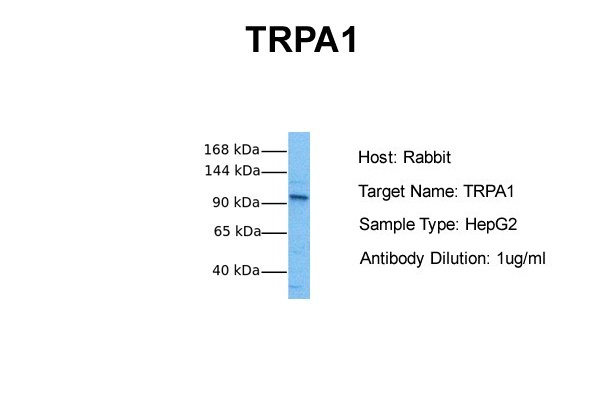 TRPA1 antibody - middle region (ARP35205_P050) in Human HepG2 using Western Blot