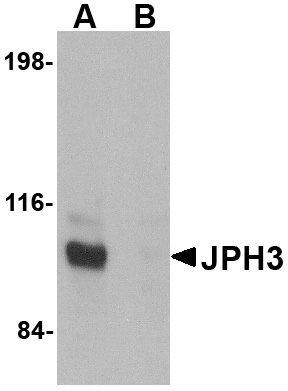 JPH3 Antibody (OAPB00790) in Daudi using Western Blot