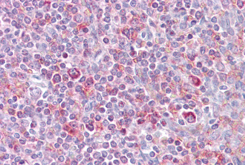 RELB antibody - N-terminal region (ARP38807_P050) in Human Spleen using Immunohistochemistry
