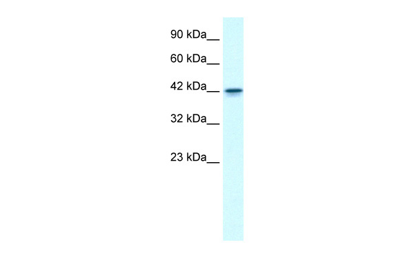 GFI1B antibody - N-terminal region (ARP30093_P050) in Human Jurkat using Western Blot
