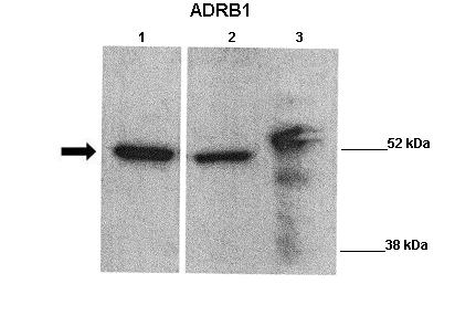 ADRB1 antibody - middle region (ARP36551_P050) in Human, Mouse using Western Blot