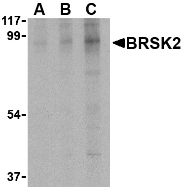 BRSK2 Antibody (OAPB00510) in Human brain using Western Blot