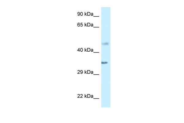 OAS1 antibody - C-terminal region (ARP30587_P050) in Human HepG2 using Western Blot