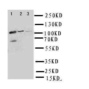 PPP1R12A Polyclonal Antibody (OABB00633) in Rat Liver, 293T, HELA using Western Blot