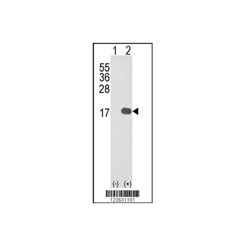 IL1F8 antibody - N-terminal region (OAAB05552) in IL1F8 using Western Blot