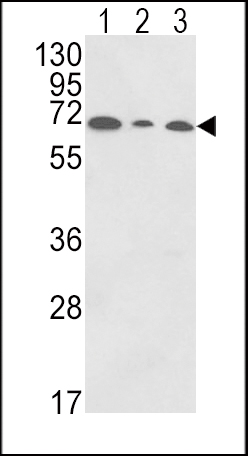 PIGR Antibody (C-term) (OAAB05147) in HepG2, K562, HL-60 using Western Blot